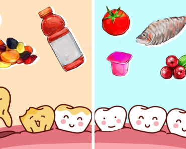 Which Foods Are Good and Bad for Your Teeth