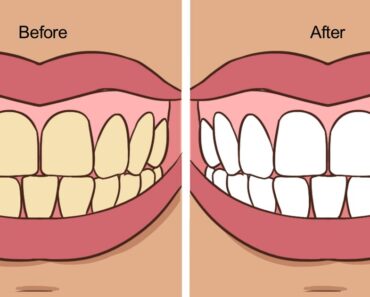 7 natural ways to whiten your teeth at home (that don’t require a trip to the dentist)