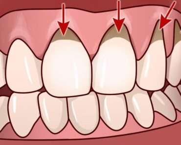 10 easy home remedies to help alleviate gum disease